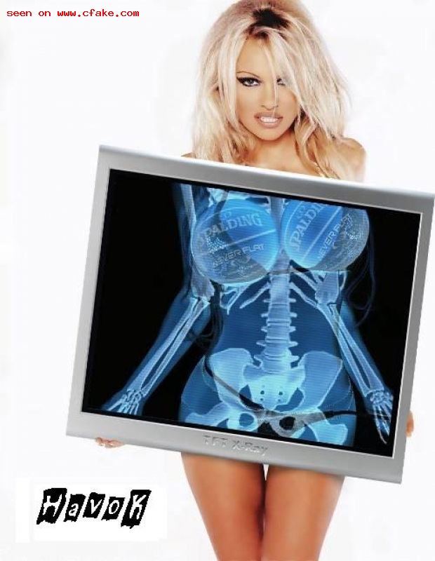 Pamela Anderson X-Ray Nude See Through photos